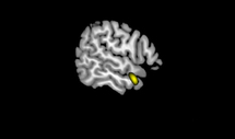 Una relación íntima y positiva con Dios estaría relacionada con un mayor volumen del gyrus temporal medio. Fuente: PLOSONE.