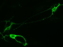 Neuronas dopaminérgicas generadas por reprogramación de astrocitos. Imagen: Russell Addis. Fuente: Perelman School of Medicine, Universidad de Pensilvania.