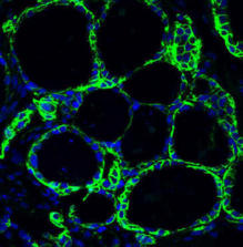 Tinción de yodo (verde) metabolizado por los folículos tiroideos obtenidos in vitro. Imagen: S. Costagliola.