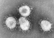 El SARS Co-V, coronavirus que inició la epidemia de SARS de 2003. Fuente: Wikipedia.