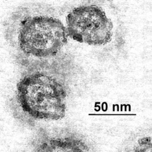 El virus de la hepatitis C. Fuente: Wikipedia.