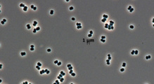 La bacteria descubierta ahora en dos salas blancas distintas. Imagen: NASA/JPL-Caltech