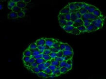 El modelo 3D de las células cancerosas mostró una tasa de proliferación y una expresión de proteínas más alta. Fuente: IOP Publishing.