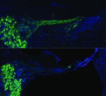 Comparación del nervio coclear tras la terapia génica de neurotrofina (arriba), frente a la cóclea sin tratar del mismo animal (abajo). Fuente: UNSW.