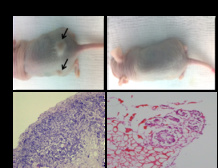 Cortes histológicos de un tumor primario antes y después de ser tratado con Bozepinib. Fuente: UGR.