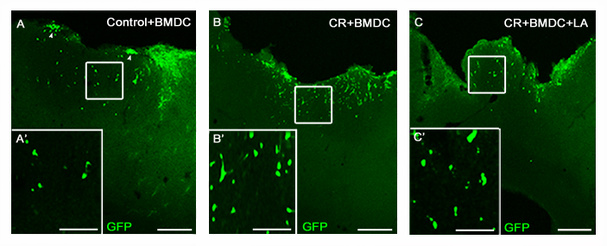 Implante de células madre de medula ósea procedente de ratones transgénicos para GFP en corteza cerebral tras lesión cerebral local, junto con una terapia farmacológica neuroprotectora. Fuente: Universidad CEU Cardenal Herrera/AlphaGalileo.