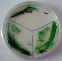 Biomasa de 'Synechococcus' en medio sólido. Fuente: UA.