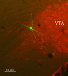 Cuerpo de una neurona dopaminérgica de la VTA cuyo axón inerva amplios territorios cerebrales. Fuente: UAM.