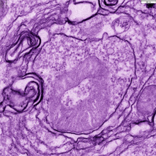 Mitocondria dentro de un autofagosoma durante el proceso de mitofagia. Fuente: CSIC.