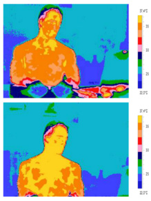 Termografía de una persona antes de ver a la persona amada (arriba) y después (abajo). Fuente: UGR.