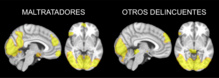 Áreas del cerebro que mostraban diferencias entre maltratadores y otros delincuentes. Fuente: UGR.