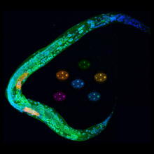 Larva y embriones de ‘Caenorhabditis elegans’. En la larva se aprecia que MEL-28/ELYS (verde) se localiza en la envoltura nuclear que rodea la cromatina (azul) de todas las células. Fuente: CSIC