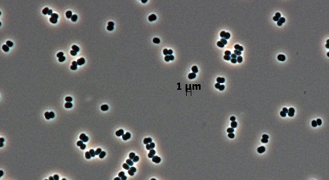 La bacteria descubierta ahora en dos salas blancas distintas. Imagen: NASA/JPL-Caltech