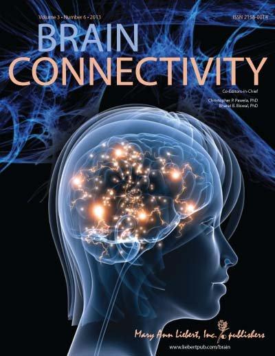 Portada de 'Brain Connectivity', revista que recoge el estudio. Fuente: AlphaGalileo.