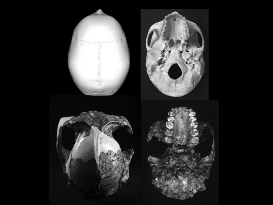 A la izquierda, vistas superior e inferior del cráneo OH5 ('Paranthropus boisei'). A la derecha, mismas vistas de un cráneo de 'Homo sapiens'. Fuente: UGR.