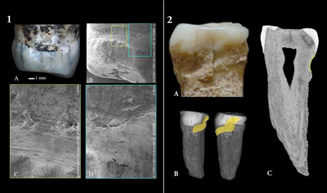 Premolar Yiyuan y premolar Sima del Elefante. Fuentes: YVPP y Cenieh.