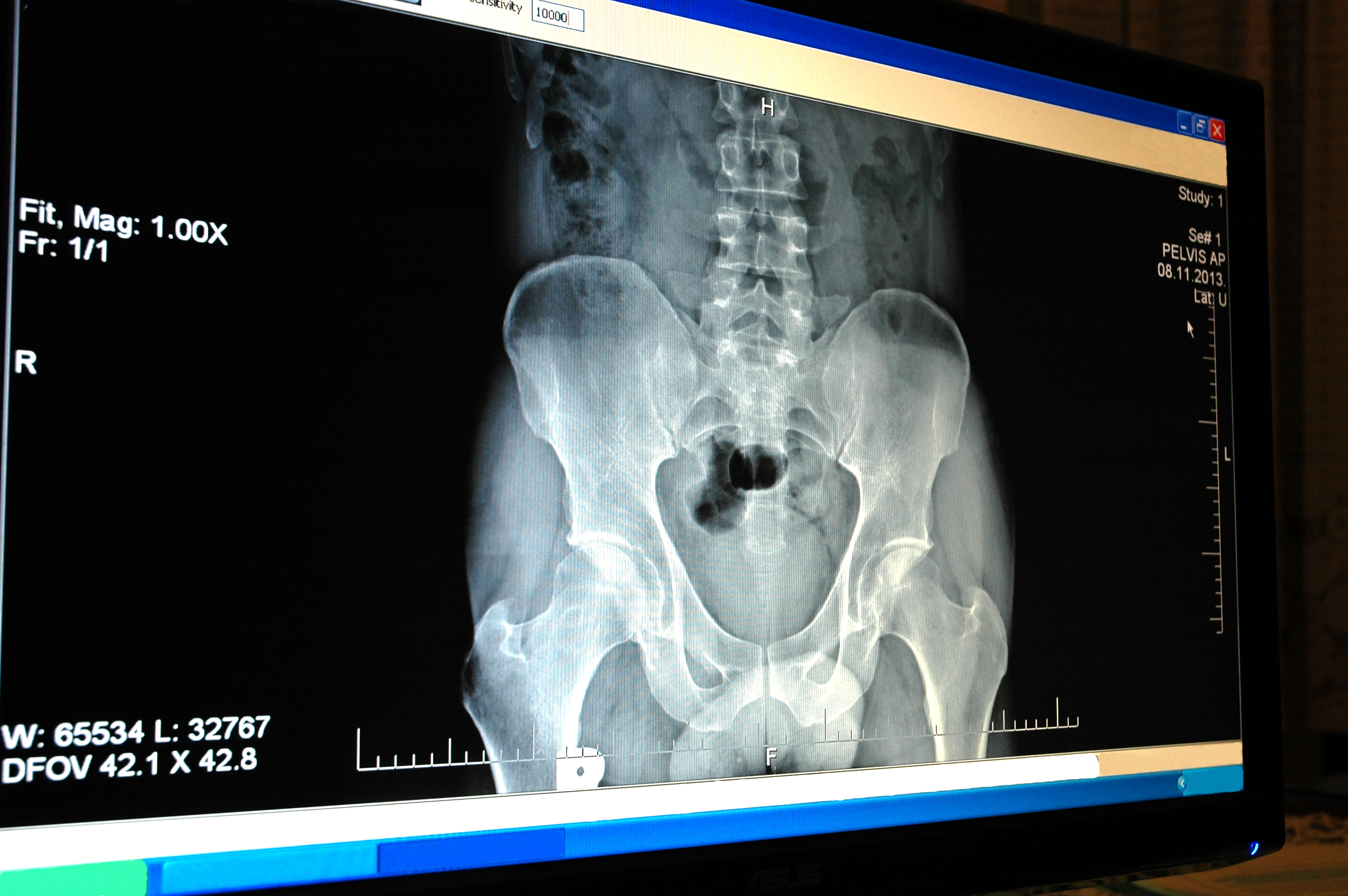 El sistema obtiene radiografías en cinco segundos. Fuente: AlphaGalileo.