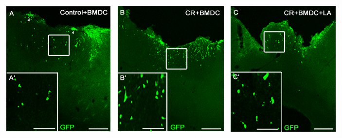 Implante de células madre de medula ósea procedente de ratones transgénicos para GFP en corteza cerebral tras lesión cerebral local, junto con una terapia farmacológica neuroprotectora. Fuente: Universidad CEU Cardenal Herrera/AlphaGalileo.