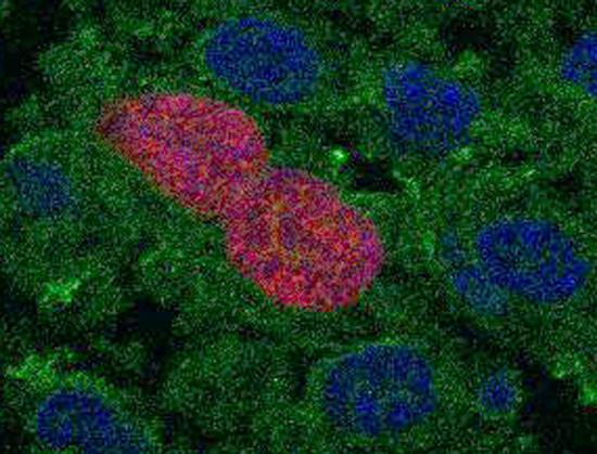 Proliferación inducida por la presencia de la proteína AID en células epiteliales de páncreas. Fuente: CNIC.