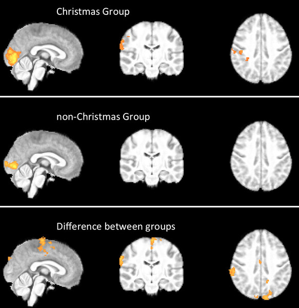 Activación cerebral en el grupo navideño (arriba), el no-navideño (centro), y diferencias entre ambos (abajo). Fuente: BMJ.