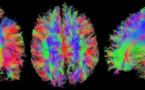 Identifican la zona del cerebro relacionada con el perdón