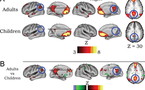 Las redes de actividad cerebral de los niños son diferentes a las de los adultos