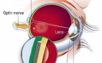 Las primeras prótesis de retina podrían llegar al mercado en 2011