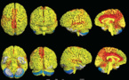 El cerebro de la mujer es más activo que el del hombre