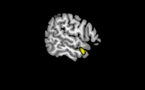 Identificadas las áreas del cerebro relacionadas con la experiencia religiosa