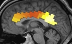 La “autotrascendencia” depende de un área concreta del cerebro