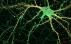 Cartografían por primera vez un microcircuito cerebral 