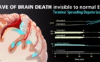 Descubren lo que pasa en el cerebro humano en el momento de la muerte