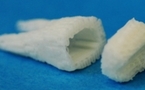 Nueva tecnología desarrolla dientes artificiales en el interior de la boca