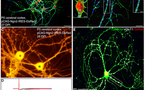 Crean neuronas a partir de otras células del cerebro