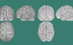 Cada persona tiene una anatomía cerebral única