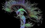 El cerebro humano madura igual que Internet