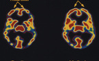 La neuroteología permitirá comprender la relación entre conciencia y mundo material