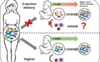 El parto por cesárea afecta a la flora intestinal del bebé
