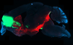 Identificado el circuito cerebral de la adicción a las drogas