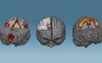 Podemos modificar el cerebro mediante el entrenamiento