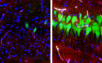 La muerte cerebral no es totalmente irreversible