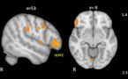 La desconexión cerebral, relacionada con la conducta disruptiva