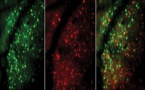 El aprendizaje provoca cambios profundos en el cerebro