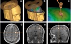 Consiguen mejorar la percepción visual con estimulación magnética