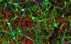 El reloj interno de las neuronas, y no su entorno, determina el momento de su muerte