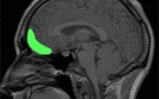 Los traumas infantiles cambian el cerebro y predisponen a la violencia