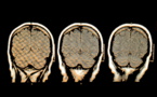 El cerebro funciona con la materia de los sueños