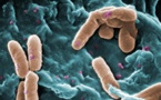 El intestino de los pacientes con VIH recluta bacterias que ayudan al virus a expandirse