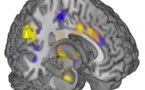 Identifican con gran exactitud la huella neuronal del dolor físico