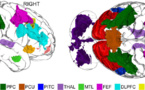 Una red neuronal se activa por todo el cerebro cuando pensamos en cosas que no existen 